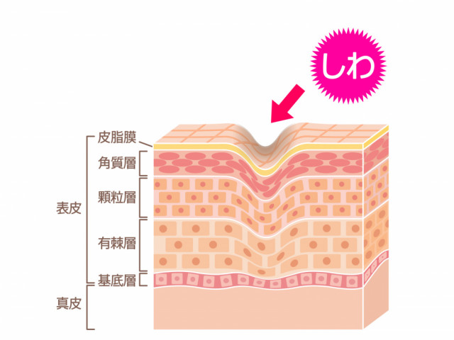シワ改善に際し大切にしていること