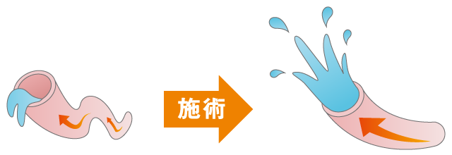 血流が良くなることで疲れ顔を改善に導きます。